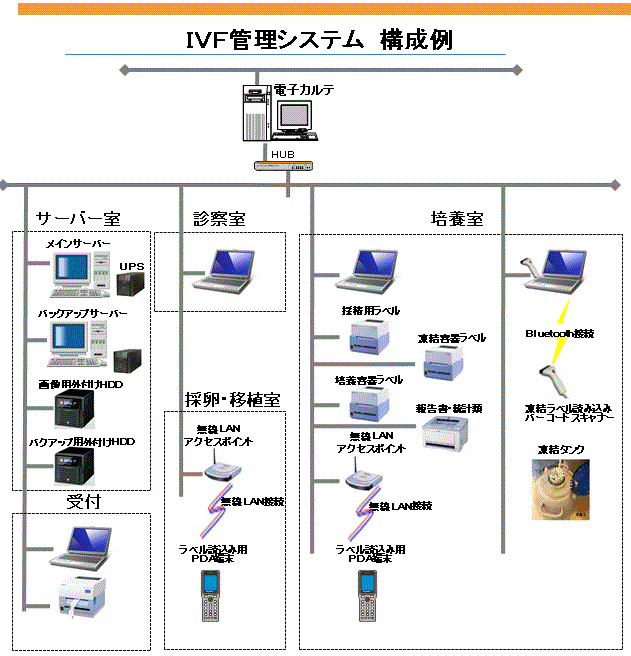 ivf_compose1.gif