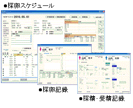 採卵スケジュール