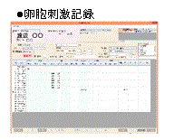 卵胞刺激記録